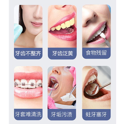 博皓便攜式智能洗牙器 開啟高效、便捷的口腔清潔新體驗(yàn)